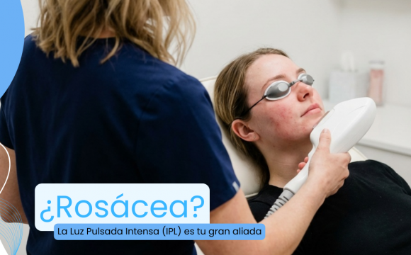 ¿Rosácea?
